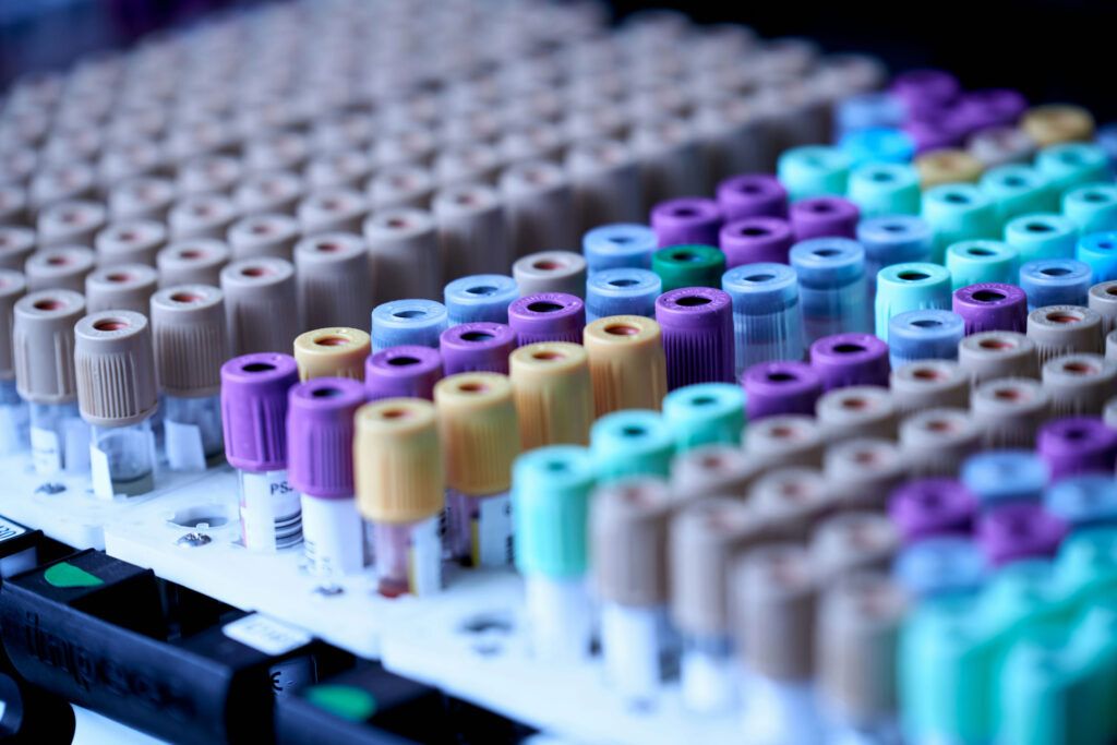 La industria farmacéutica: un sector en plena transformación con un reclutamiento bajo fuerte presión